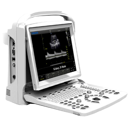 Echographe portable à ultrasons Chison ECO3 EXPERT