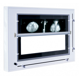 Ngatoscope format spcial mammographies  volets (10 clichs de 18x24)