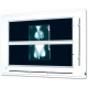 Négatoscope format spécial mammographies à volets (12 clichés de 18x24 ou 8 clichés de 24x30)