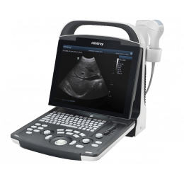Scanner à ultrasons portable sans fil pour la détermination du