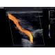 Echographe à ultrasons couleur 3D/4D Edan Acclarix LX8