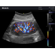 Echographe à ultrasons couleur Edan Acclarix LX3