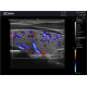Echographe à ultrasons couleur Edan Acclarix LX3
